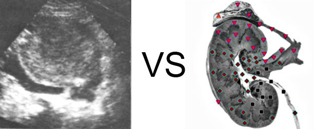 VECTOR NLS vs. Ultrasound Study (10)
