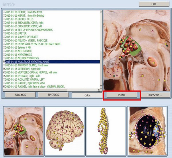 What is bioplasm 9d nls 3
