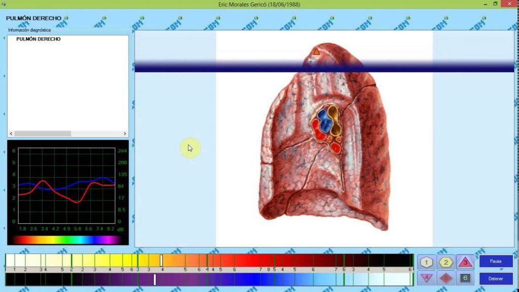 bioescaner molecular 8d