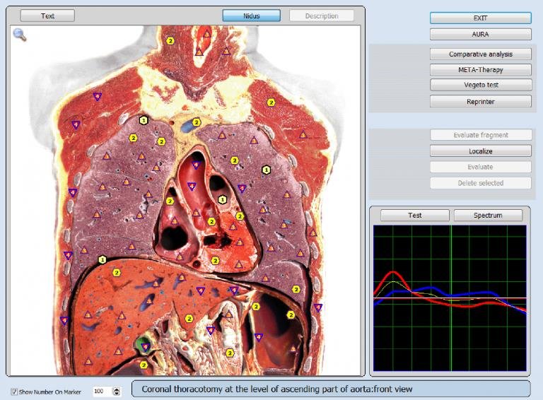 original 9d 8d nls health analyzer