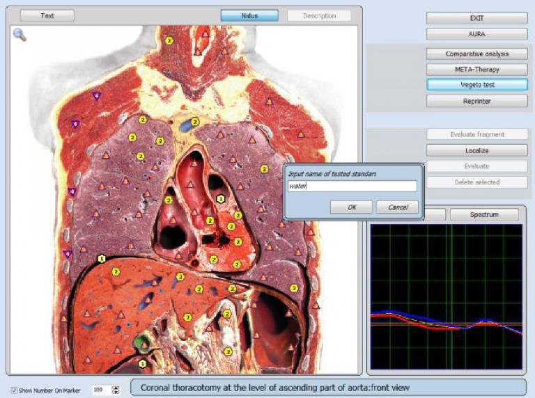 original 9d 8d nls health analyzer