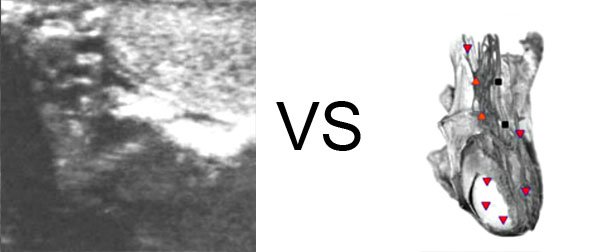3d nls vs 8d nls
