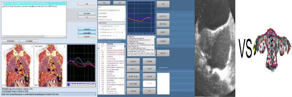 8d nls analyzer