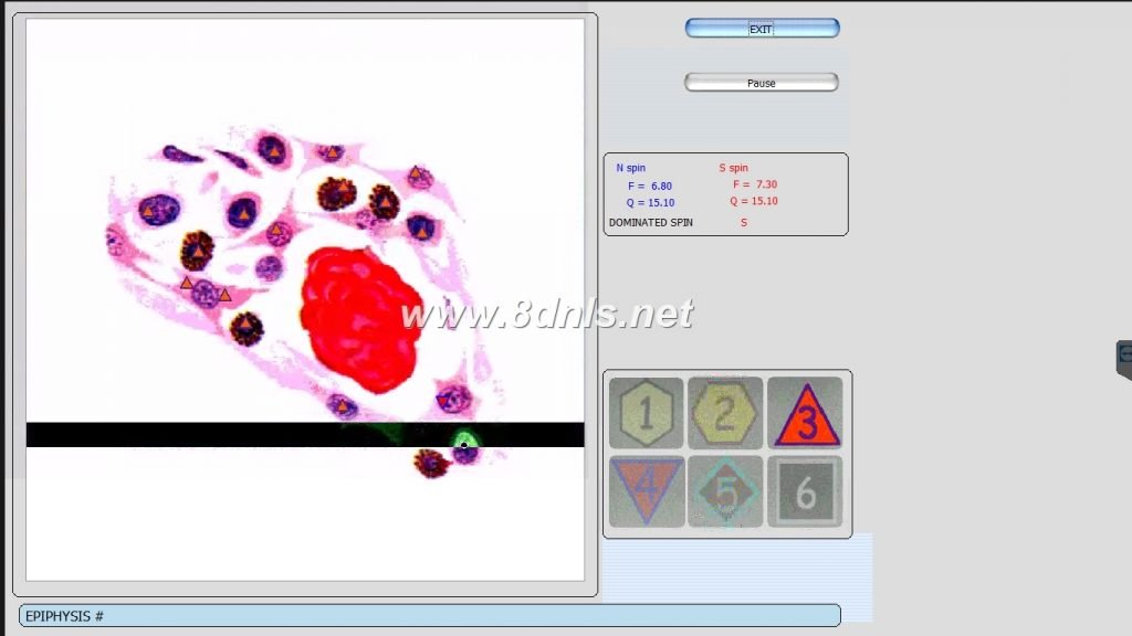 9d nls non-lined diagnostic system