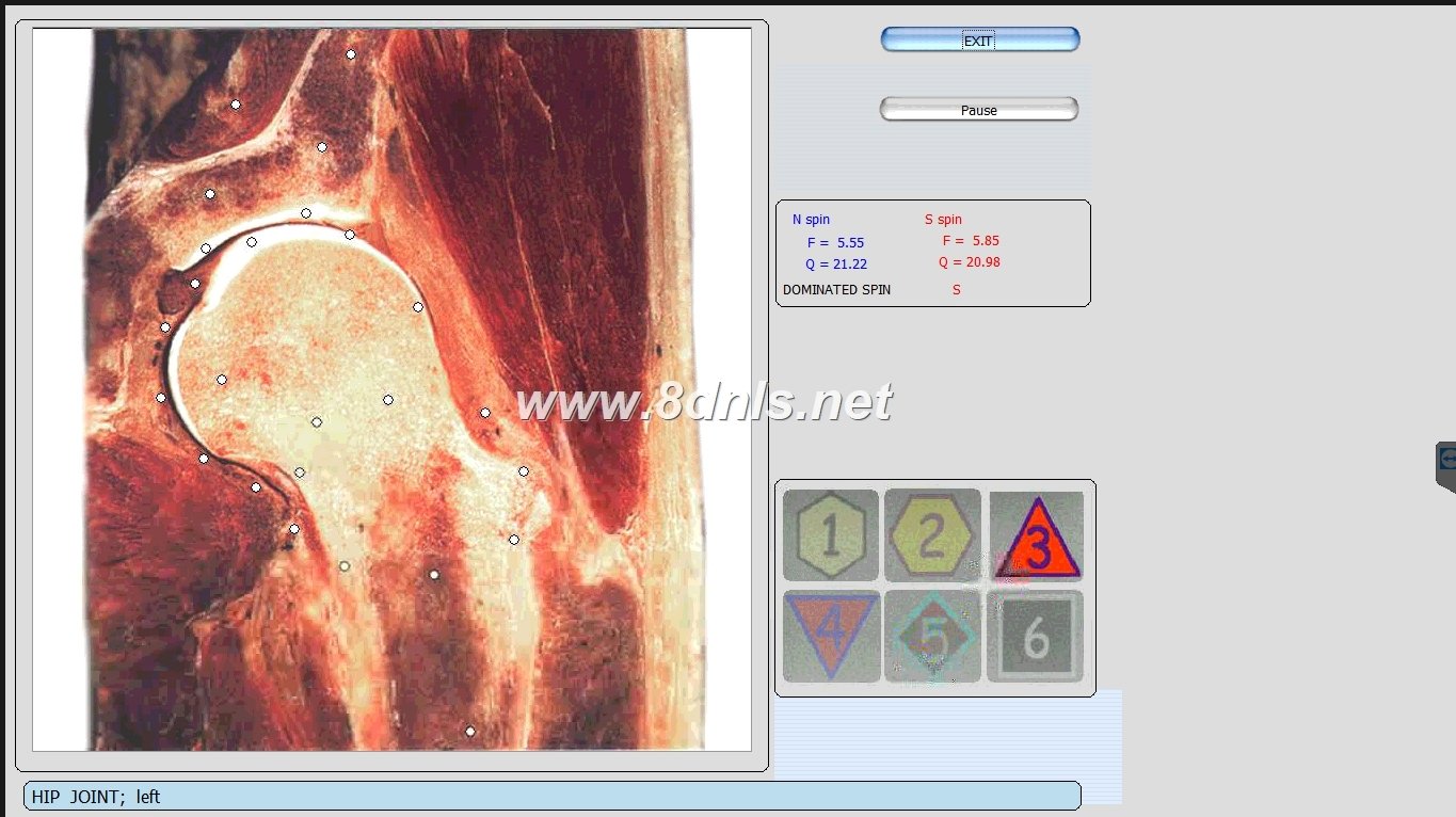 9d nls non-lined diagnostic system