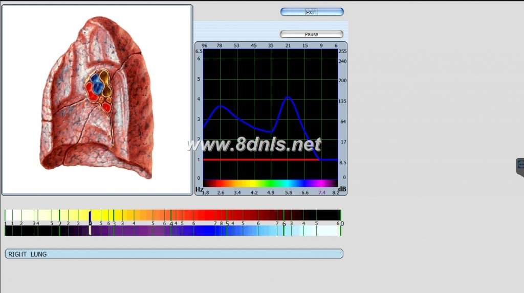 oberon nls biofeedback