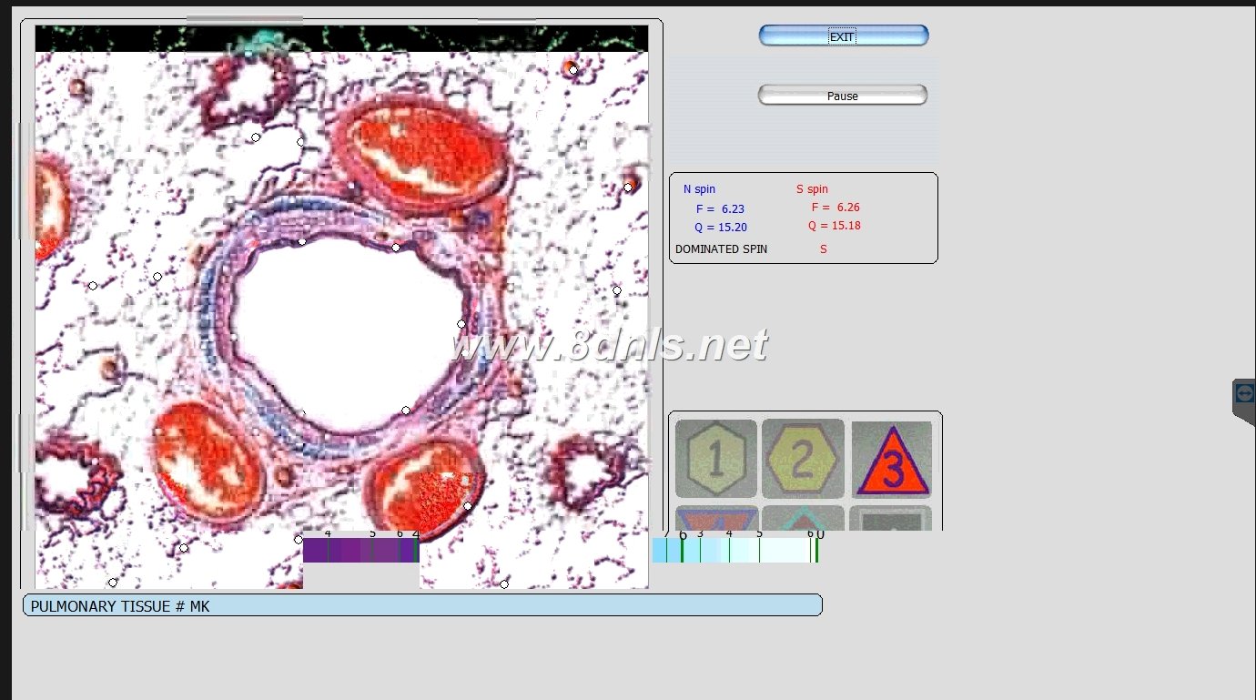 oberon nls biofeedback