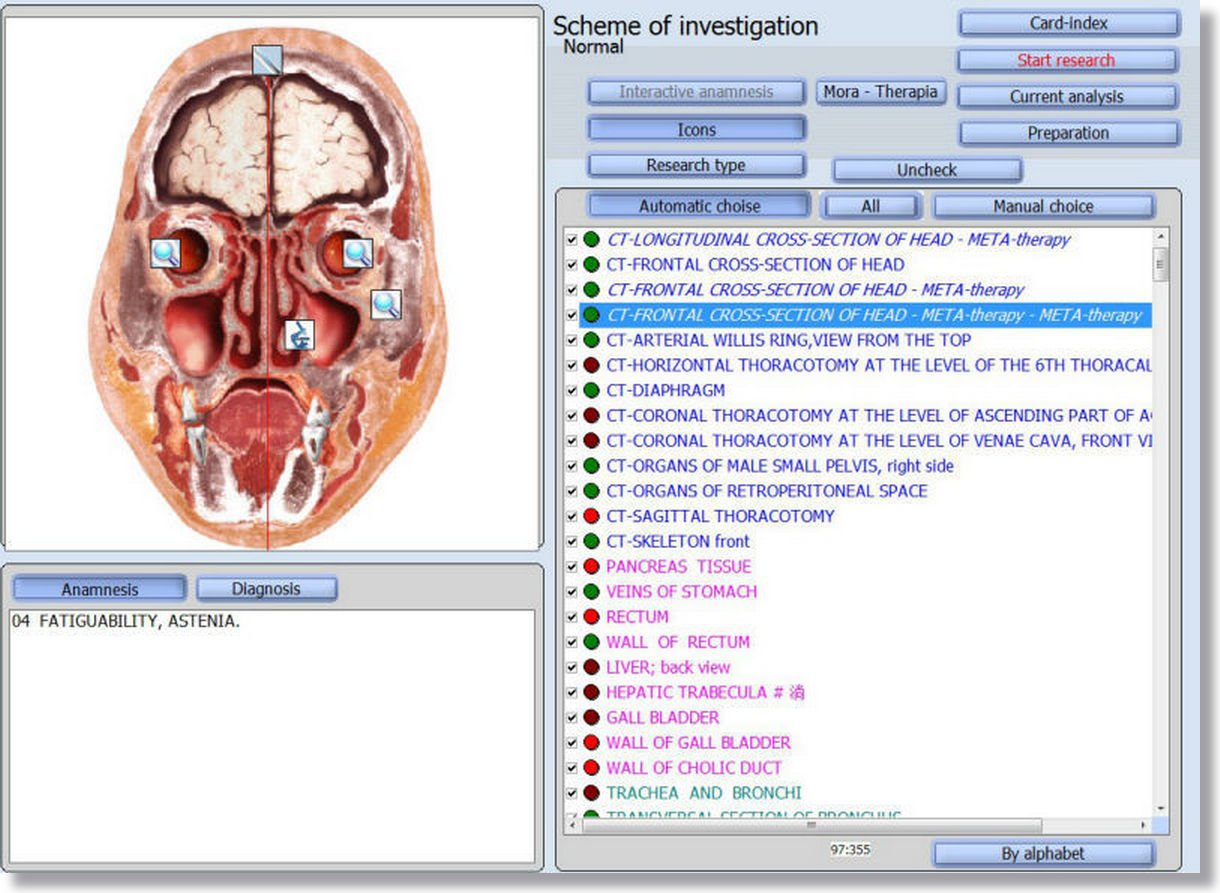 Bioplasm NLS Software: