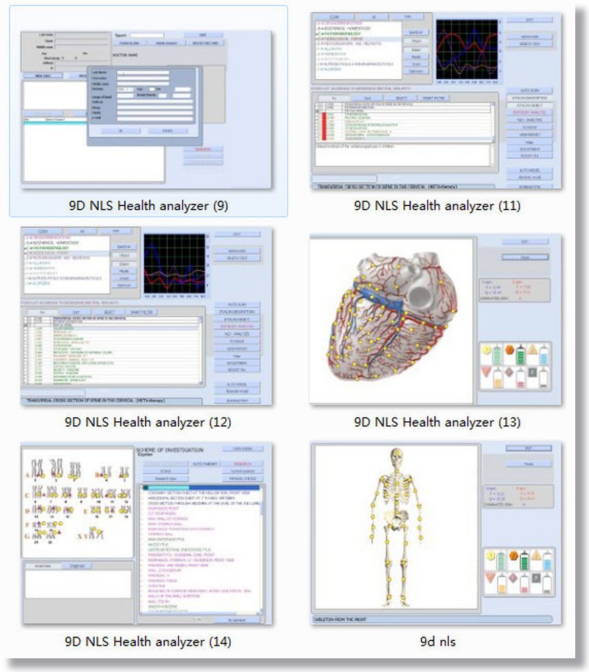 bioplasm nls software