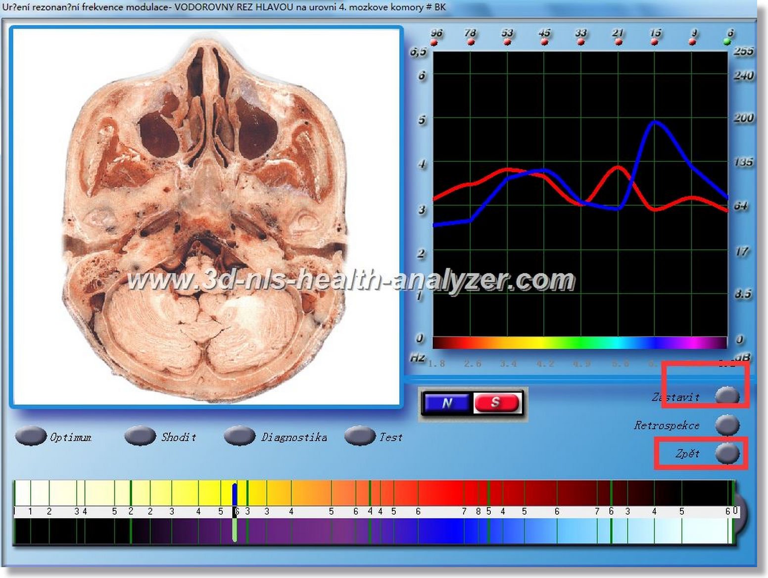headset for 3d nls health analyzer machine