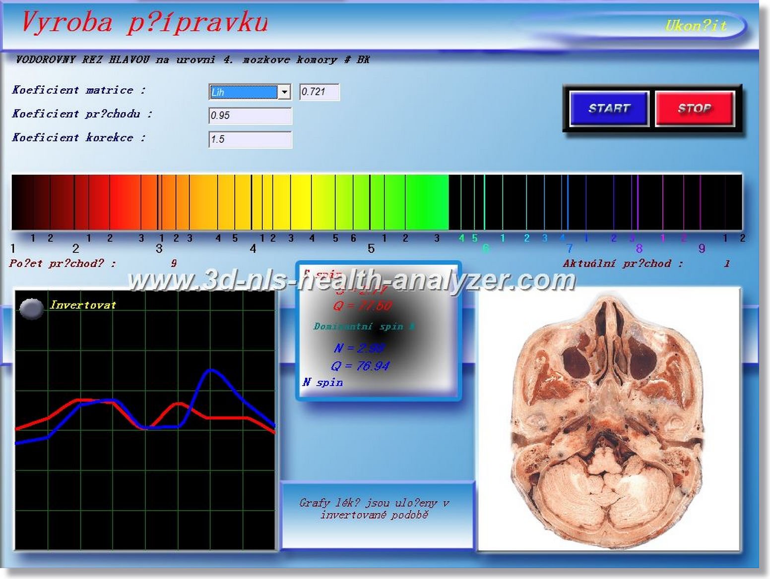 headset for 3d nls health analyzer machine