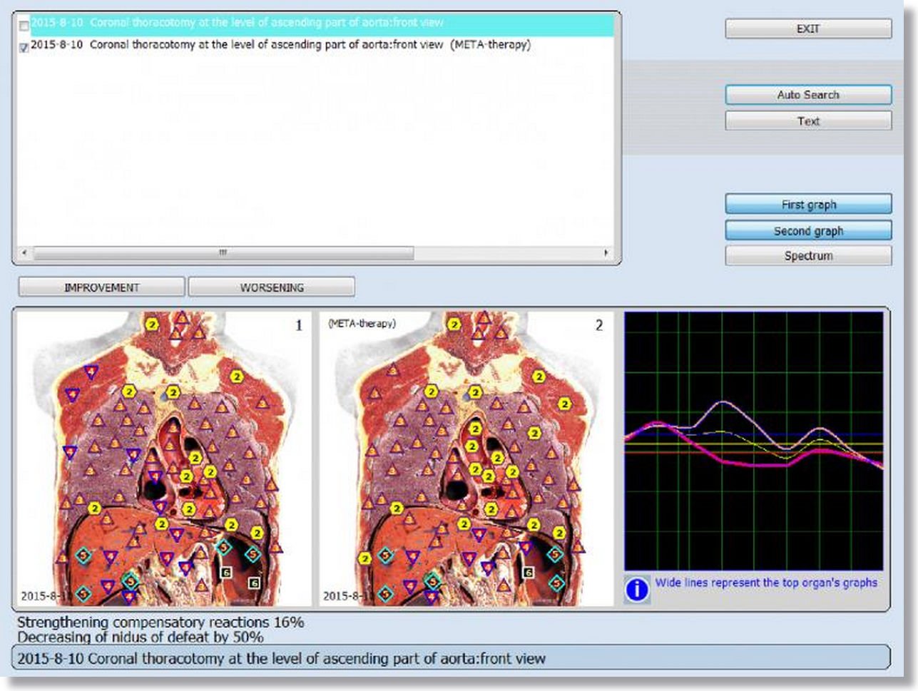 NLS Health Analyzer