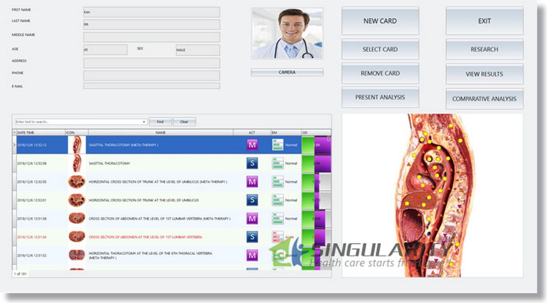 Bioplasm NLS Tomography Scanner